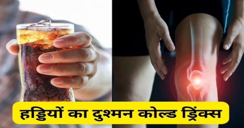 Phosphoric Acid से भरपूर Cold Drinks पीने से होगी इन न्यूट्रिएंट्स की कमी, हड्डियों में आएगी कमजोरी
